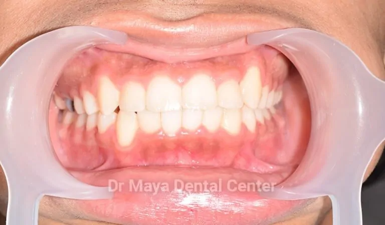 Beyond Teeth: Comprehensive Dental Care At Dental Clinics In JVC